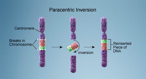 Parasentrik İnversiyon Her iki kırığın kromozom