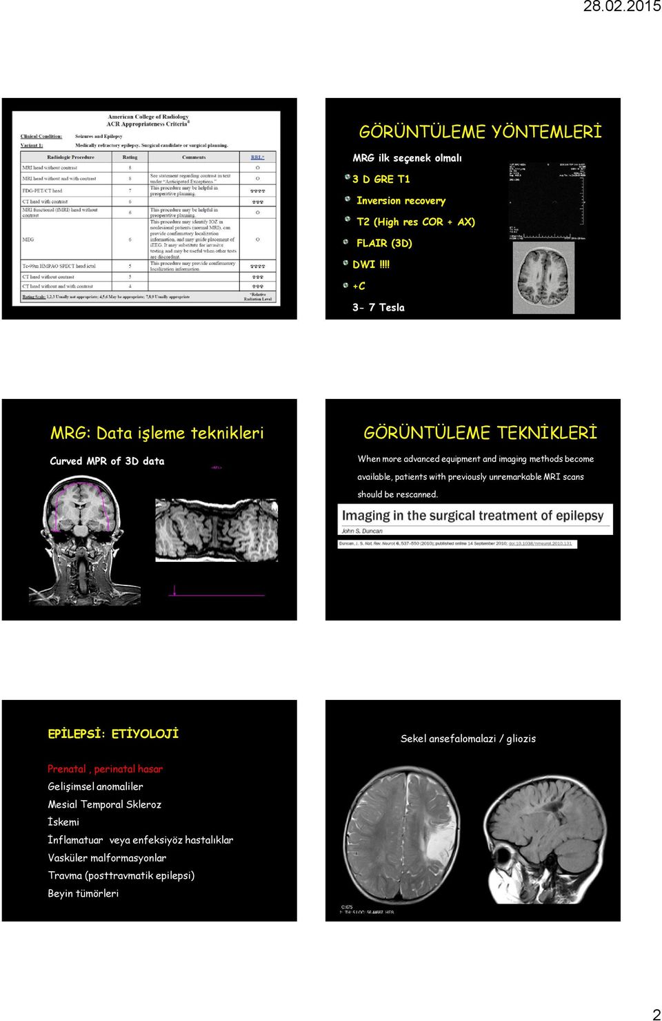 available, patients with previously unremarkable MRI scans should be rescanned.