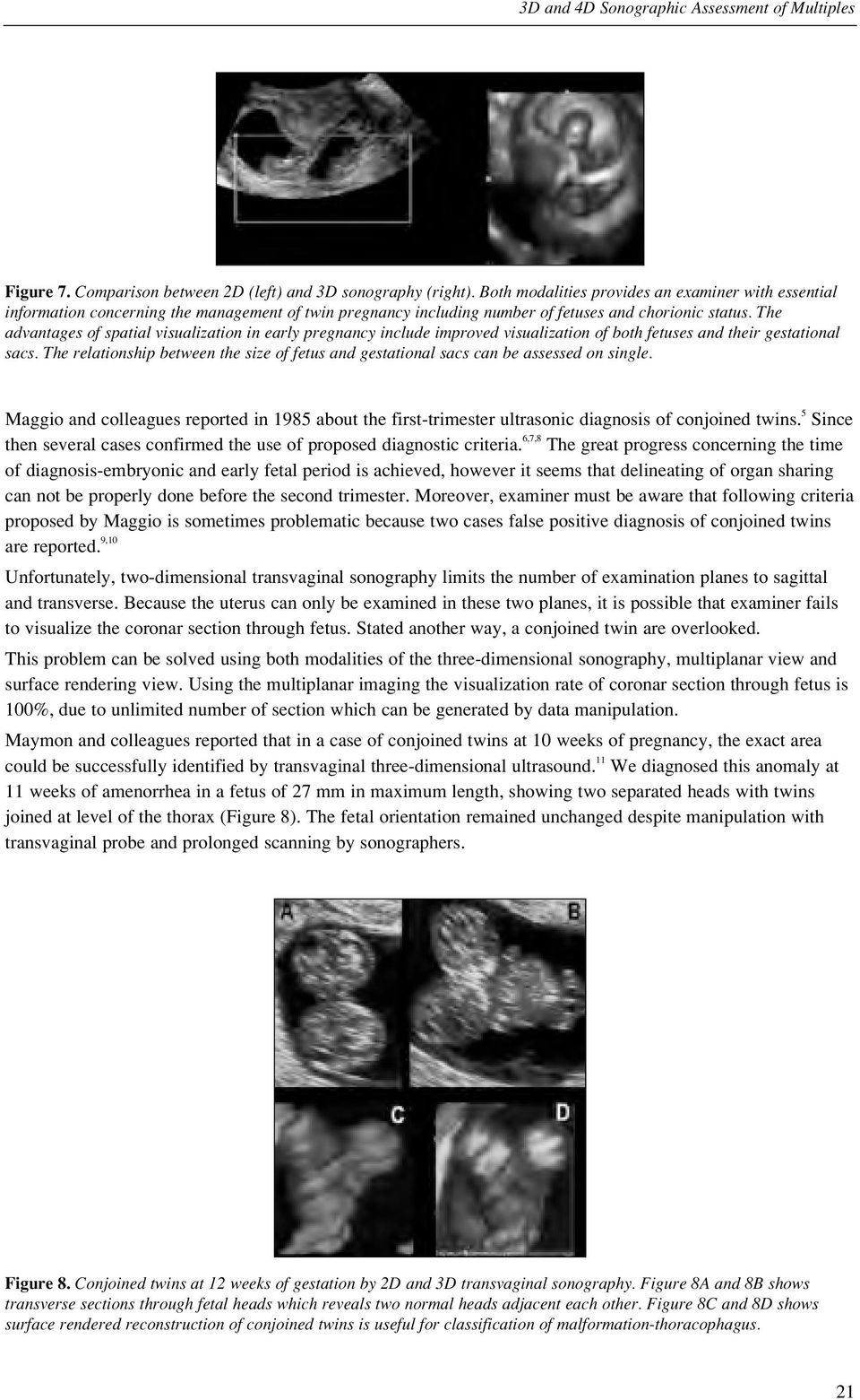 The advantages of spatial visualization in early pregnancy include improved visualization of both fetuses and their gestational sacs.