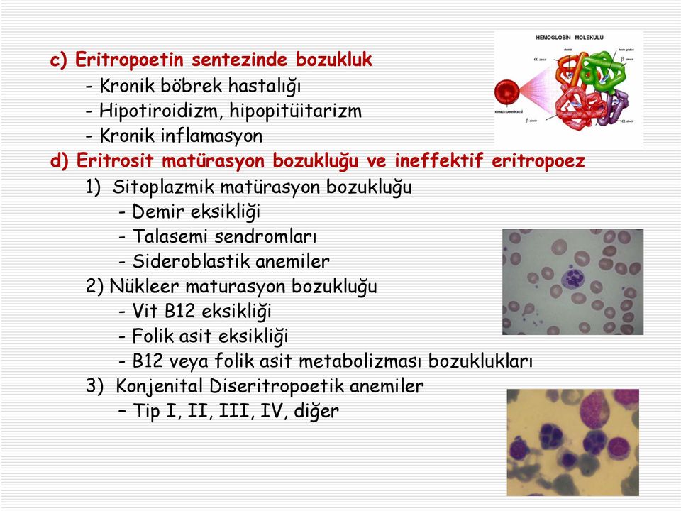 Talasemi sendromları - Sideroblastik anemiler 2) Nükleer maturasyon bozukluğu - Vit B12 eksikliği - Folik asit