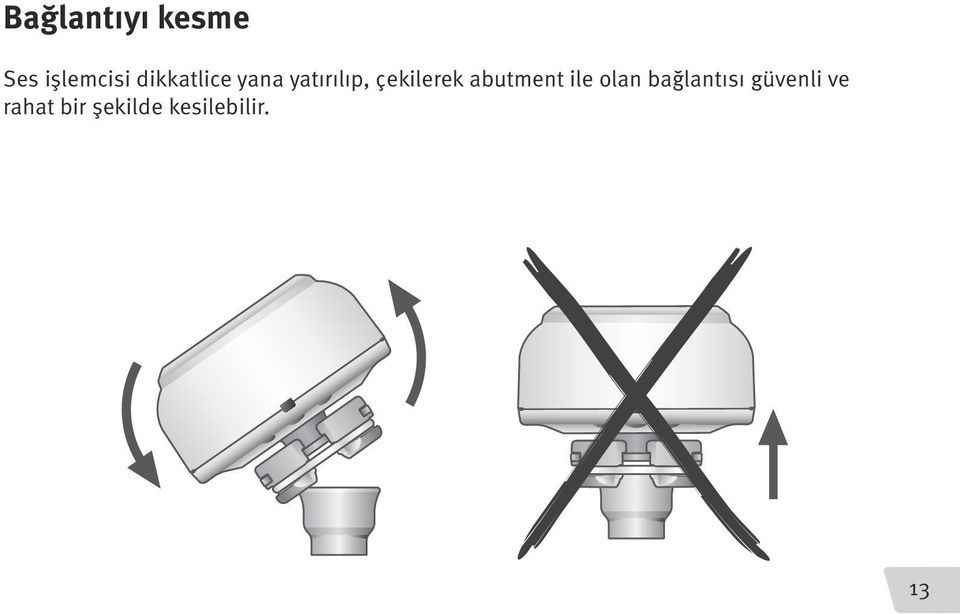 çekilerek abutment ile olan