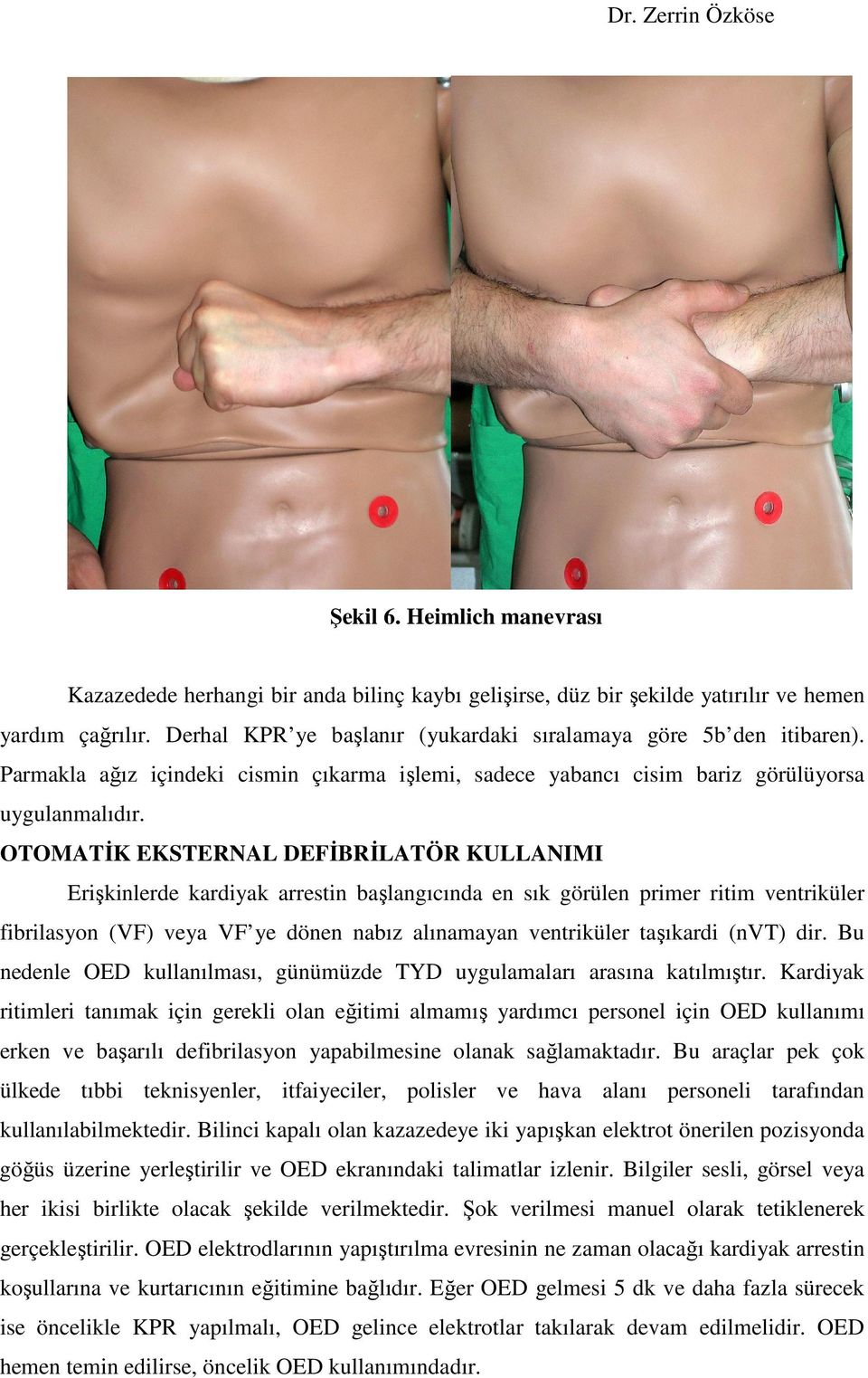 OTOMATĐK EKSTERNAL DEFĐBRĐLATÖR KULLANIMI Erişkinlerde kardiyak arrestin başlangıcında en sık görülen primer ritim ventriküler fibrilasyon (VF) veya VF ye dönen nabız alınamayan ventriküler taşıkardi