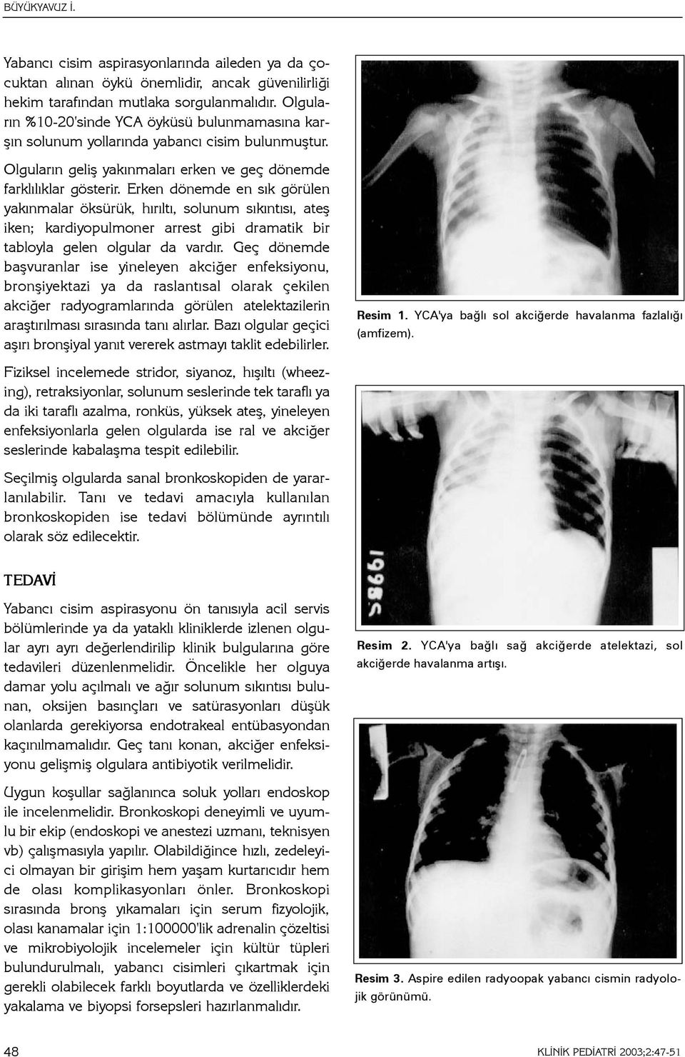 Erken dönemde en sýk görülen yakýnmalar öksürük, hýrýltý, solunum sýkýntýsý, ateþ iken; kardiyopulmoner arrest gibi dramatik bir tabloyla gelen olgular da vardýr.