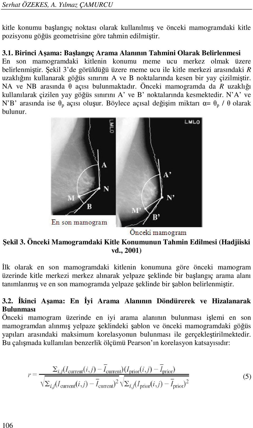 Şekil 3 de görüldüğü üzere meme ucu ile kitle merkezi arasındaki R uzaklığını kullanarak göğüs sınırını A ve B noktalarında kesen bir yay çizilmiştir. NA ve NB arasında θ açısı bulunmaktadır.