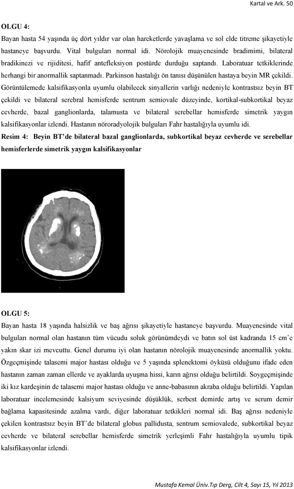 Parkinson hastalığı ön tanısı düşünülen hastaya beyin MR çekildi.