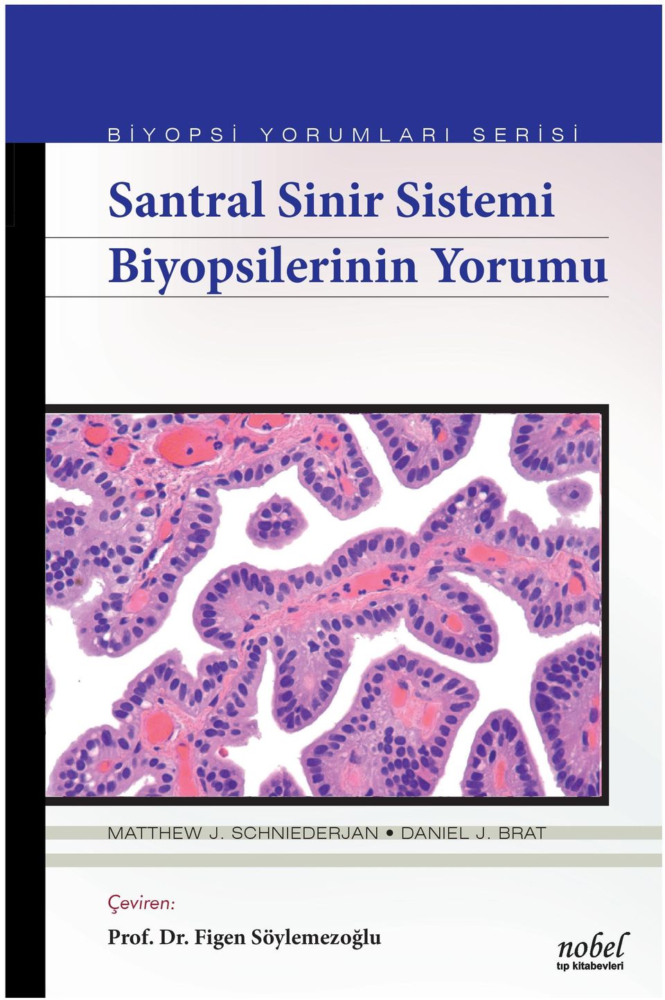 Ayırıcı tanı; yaş, klinik prezentasyon, yerleşim yeri ve nörogörüntüleme temel alınarak oluşturulurken, patolojik tanı; histolojik ve immunohistokimyasal özellikler ile gerektiğinde yardımcı testlere