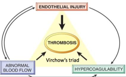 Trombofili pıhtılaşma eğiliminin dolayısı ile VTE olasılığının arttığı