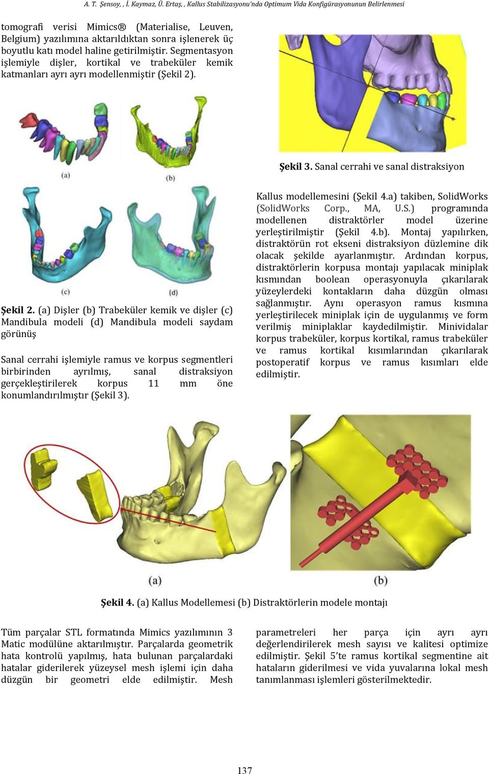 (a) Dişler (b) Trabeküler kemik ve dişler (c) Mandibula modeli (d) Mandibula modeli saydam görünüş Sanal cerrahi işlemiyle ramus ve korpus segmentleri birbirinden ayrılmış, sanal distraksiyon