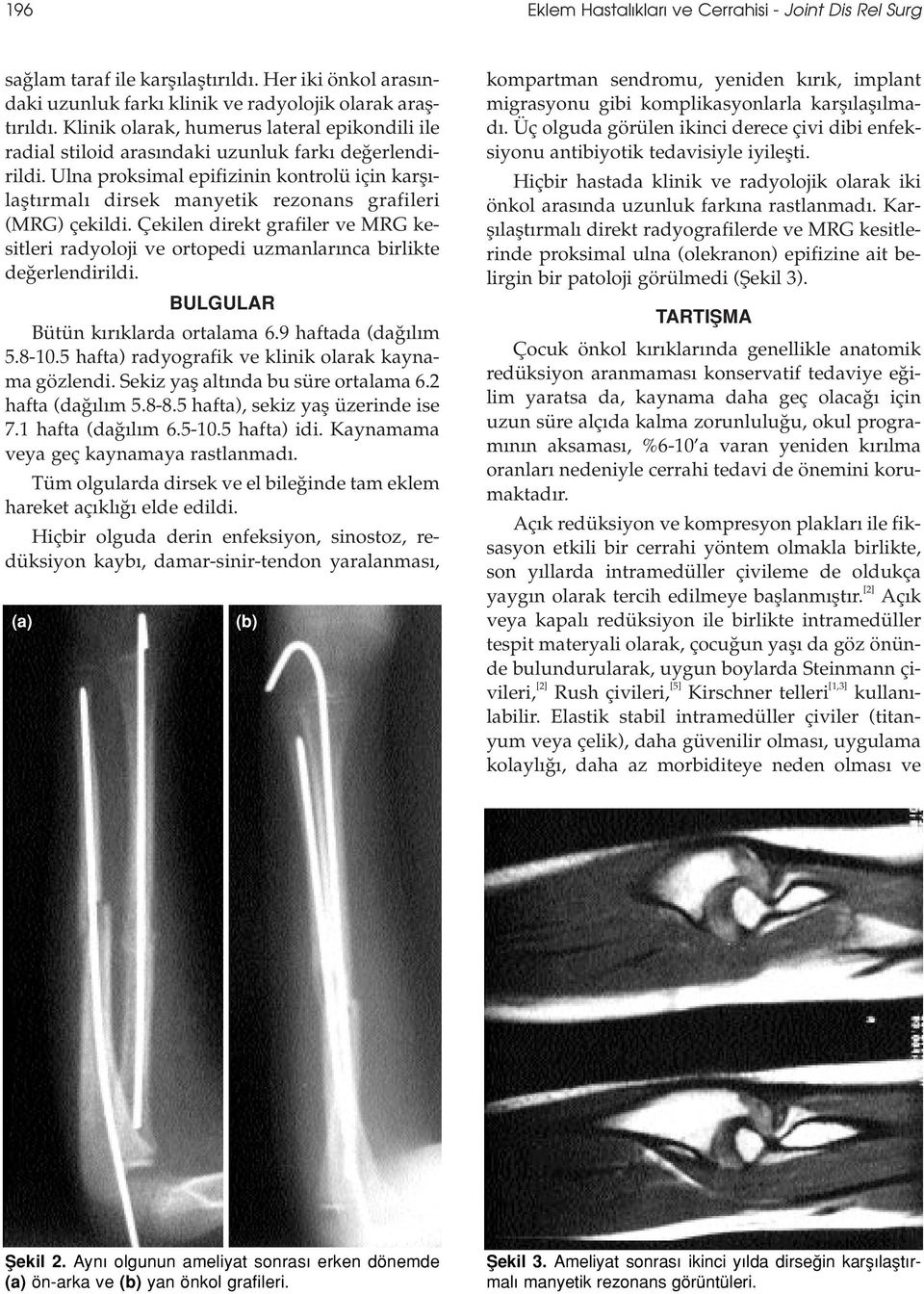 Ulna proksimal epifizinin kontrolü için karfl - laflt rmal dirsek manyetik rezonans grafileri (MRG) çekildi.