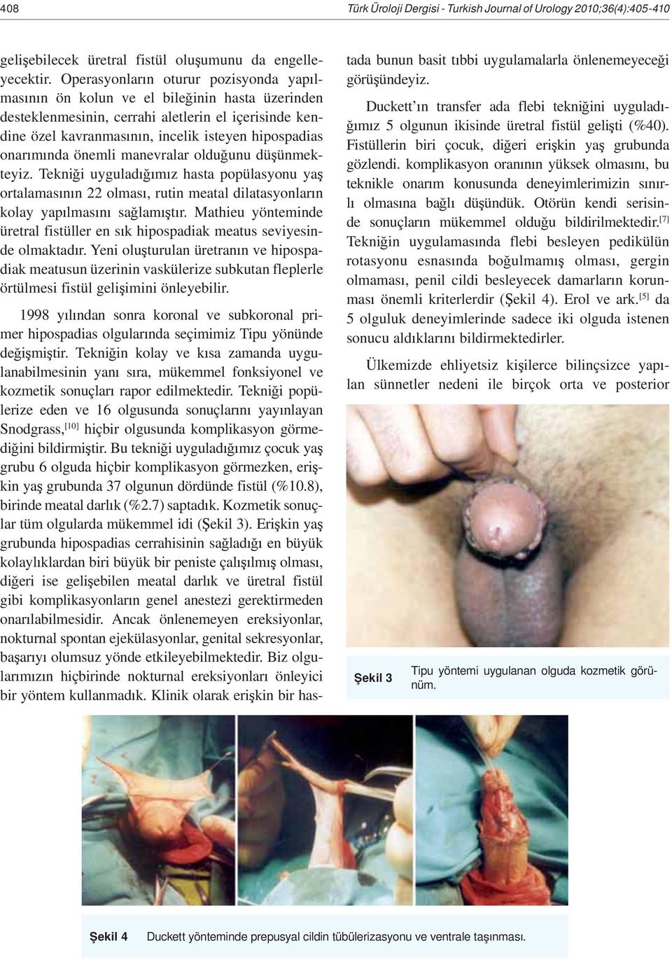 nda önemli manevralar oldu unu dü ünmekteyiz. Tekni i uygulad m z hasta popülasyonu ya ortalamas n n 22 olmas, rutin meatal dilatasyonlar n kolay yap lmas n sa lam t r.