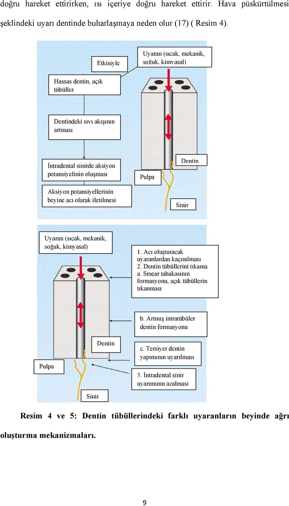 acı olarak iletilmesi Pulpa Dentin Sinir Uyaran (sıcak, mekanik, soğuk, kimyasal) 1. Acı oluşturacak uyaranlardan kaçınılması 2. Dentin tübüllerini tıkama a.