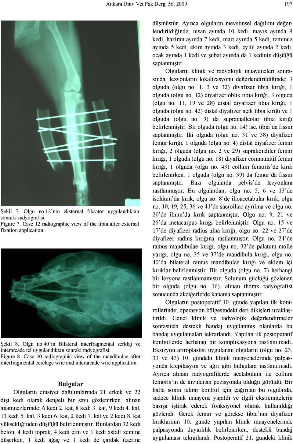 Case 40 radiographic view of the mandibulae after interfragmental cerclage wire and interarcade wire application.