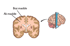 Beyin yarımkürelerini enine ayıran derin yarığa rolando yarığı denir. Beyinde bulunan çeşitli merkezler bu yarıklar boyunca sıralanmıştır.