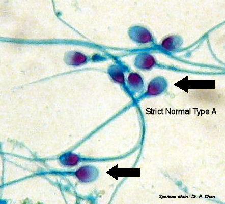 Sperm Morfolojisi