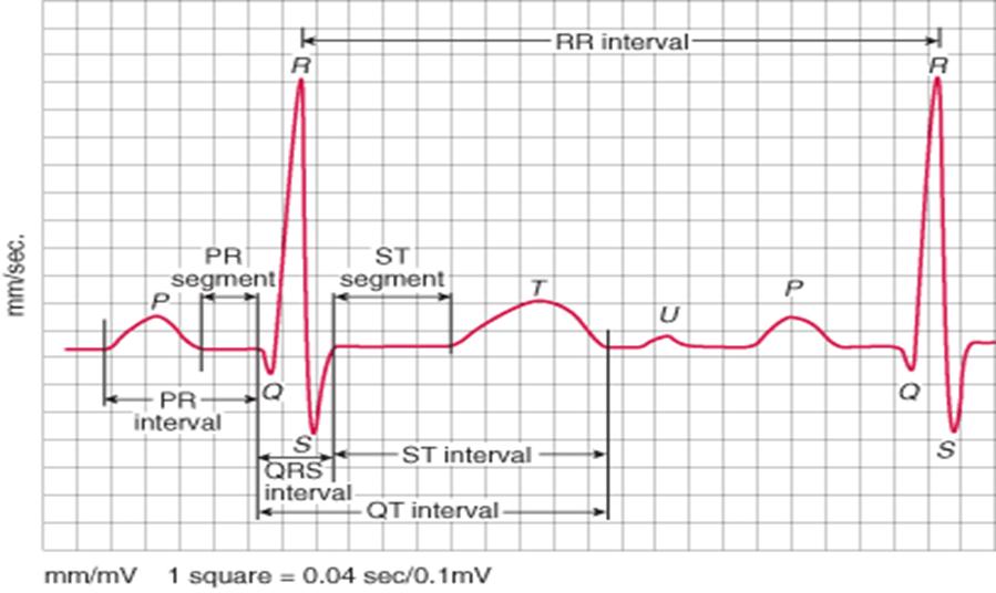 ST segmenti ST segmenti, S dalgası sonu (J noktası) ile T dalgası arasındaki yassı, izoelektrik EKG kısmıdır. Ventriküler depolarizasyon ve repolarizasyonu gösterir.