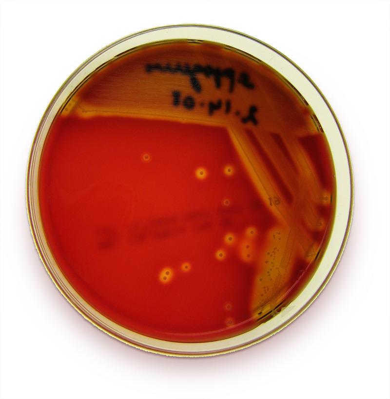 Genel amaçlı besiyerleri Plate Count Agar (PCA), Nutrient Agar veya Broth, Tryptic Soy Agar veya Broth (CASO Agar veya Broth) İnhibitör içermezler Genellikle Toplam Aerob Mezofil Bakteri sayımı için