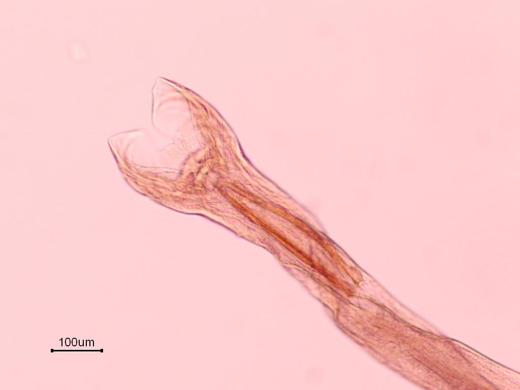 62 başlangıcındaki kalınlık 136(99-179) µm, vulvanın arka uca uzaklığı ise 2202(1761-3044) µm ölçülmüştür. Şekil 3.3. Teladorsagia circumcincta bursa copulatriks T.