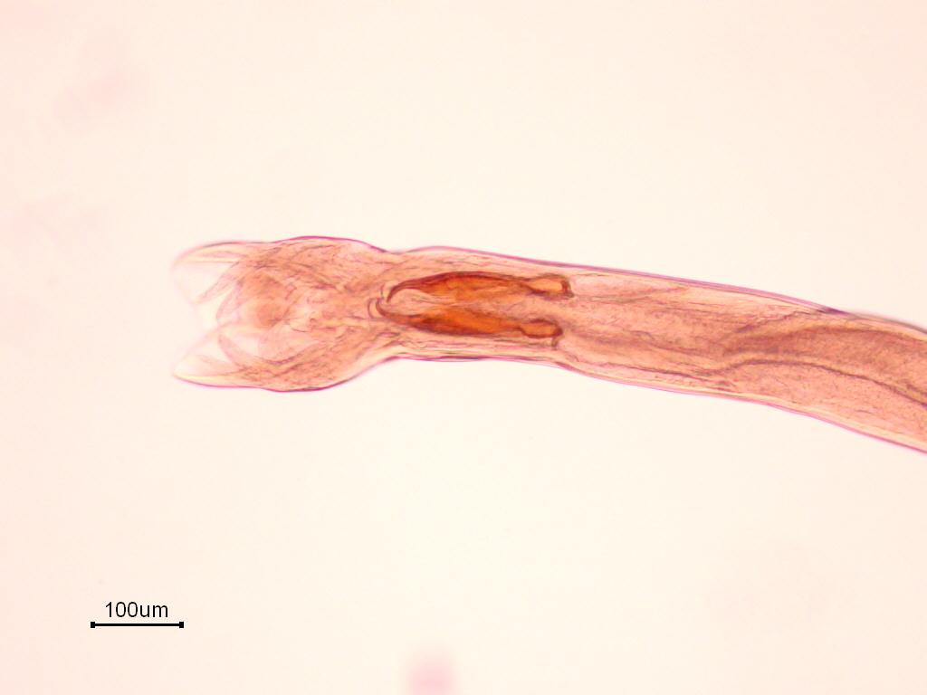 63 Şekil 3.4. Teladorsagia trifurcata bursa copulatriks T. probolurus Erkeklerinin 5,48(4,12-6,62) mm, dişilerinin ise 6,19(5,51-7,08) mm boyunda olduğu saptanmıştır.