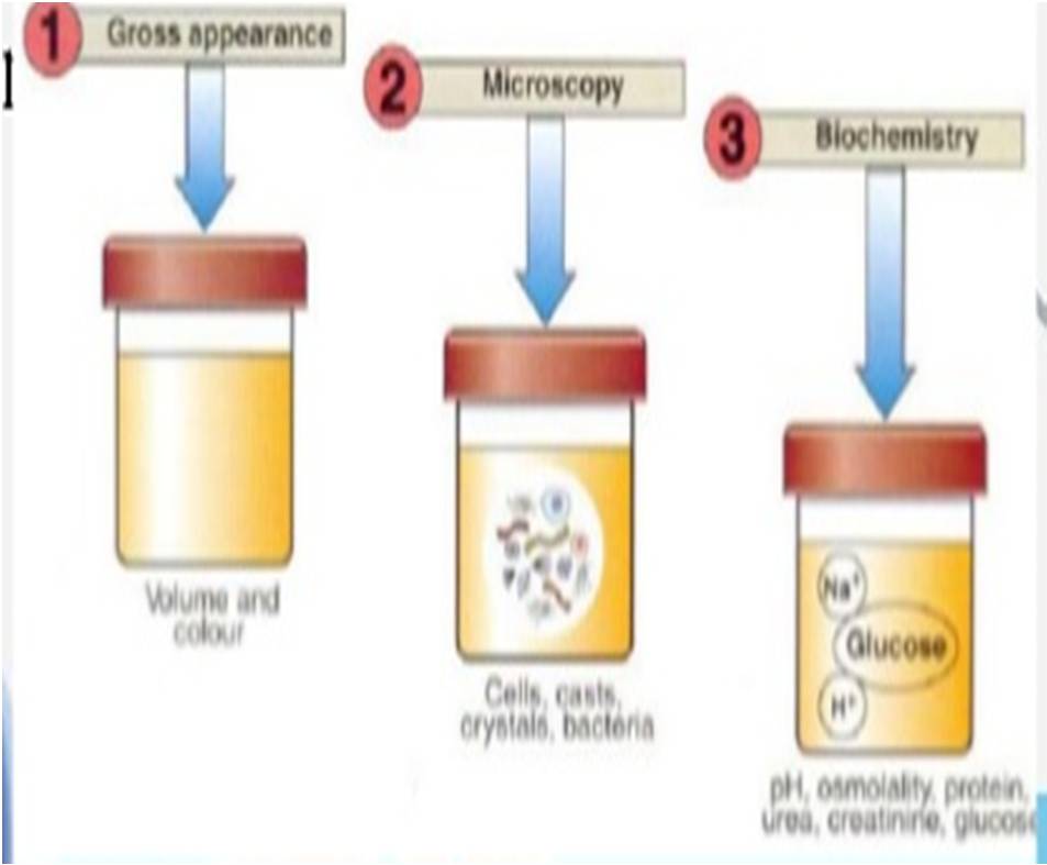 NCCLS GP16 A3 Urınalysıs and Transportatıon and Preservatıon of urıne Specımens Approved Guıdelıne Thırd Edıtıon ECLM- European Urinalysis Guidelines Örnek toplama ve transport Analiz prosedürleri