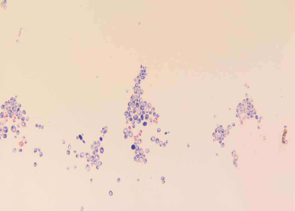 Saccharomyces Diploid somatik