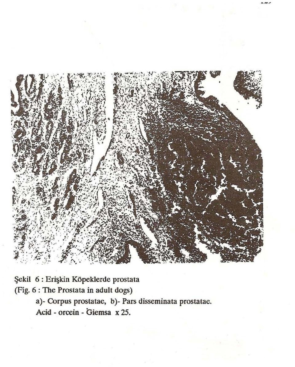 Corpus prostatae, b)- Pars disseminata