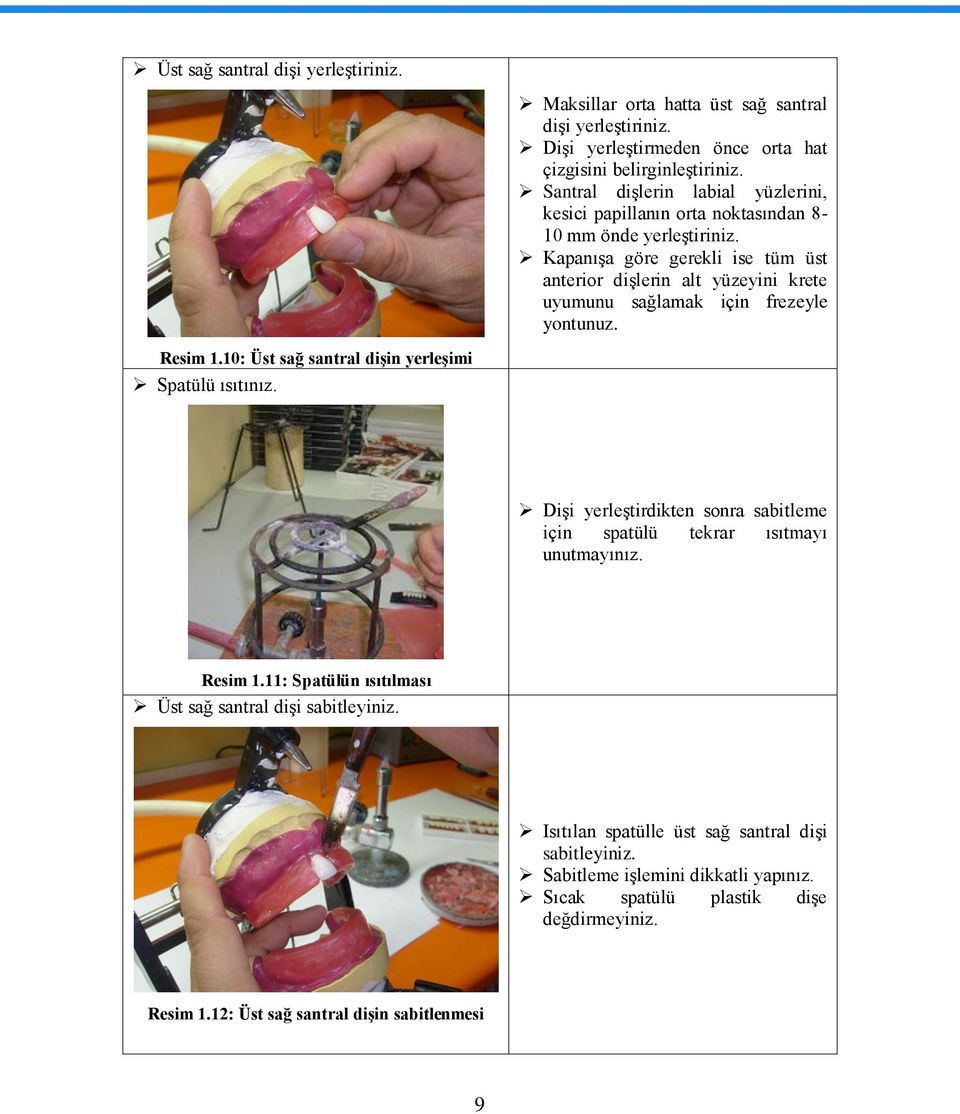 KapanıĢa göre gerekli ise tüm üst anterior diģlerin alt yüzeyini krete uyumunu sağlamak için frezeyle yontunuz. Resim 1.10: Üst sağ santral diģin yerleģimi Spatülü ısıtınız.