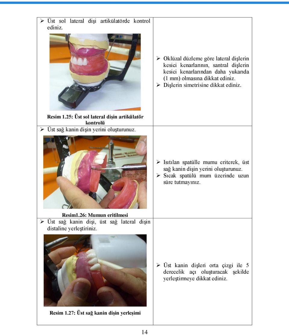 DiĢlerin simetrisine dikkat ediniz. Resim 1.25: Üst sol lateral diģin artikülatör kontrolü Üst sağ kanin diģin yerini oluģturunuz.