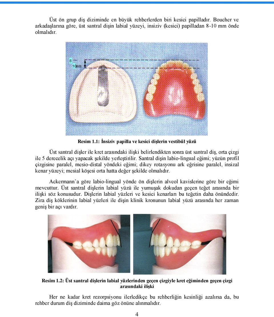 Santral diģin labio-lingual eğimi; yüzün profil çizgisine paralel, mesio-distal yöndeki eğimi; dikey rotasyonu ark eğrisine paralel, insizal kenar yüzeyi; mesial köģesi orta hatta değer Ģekilde