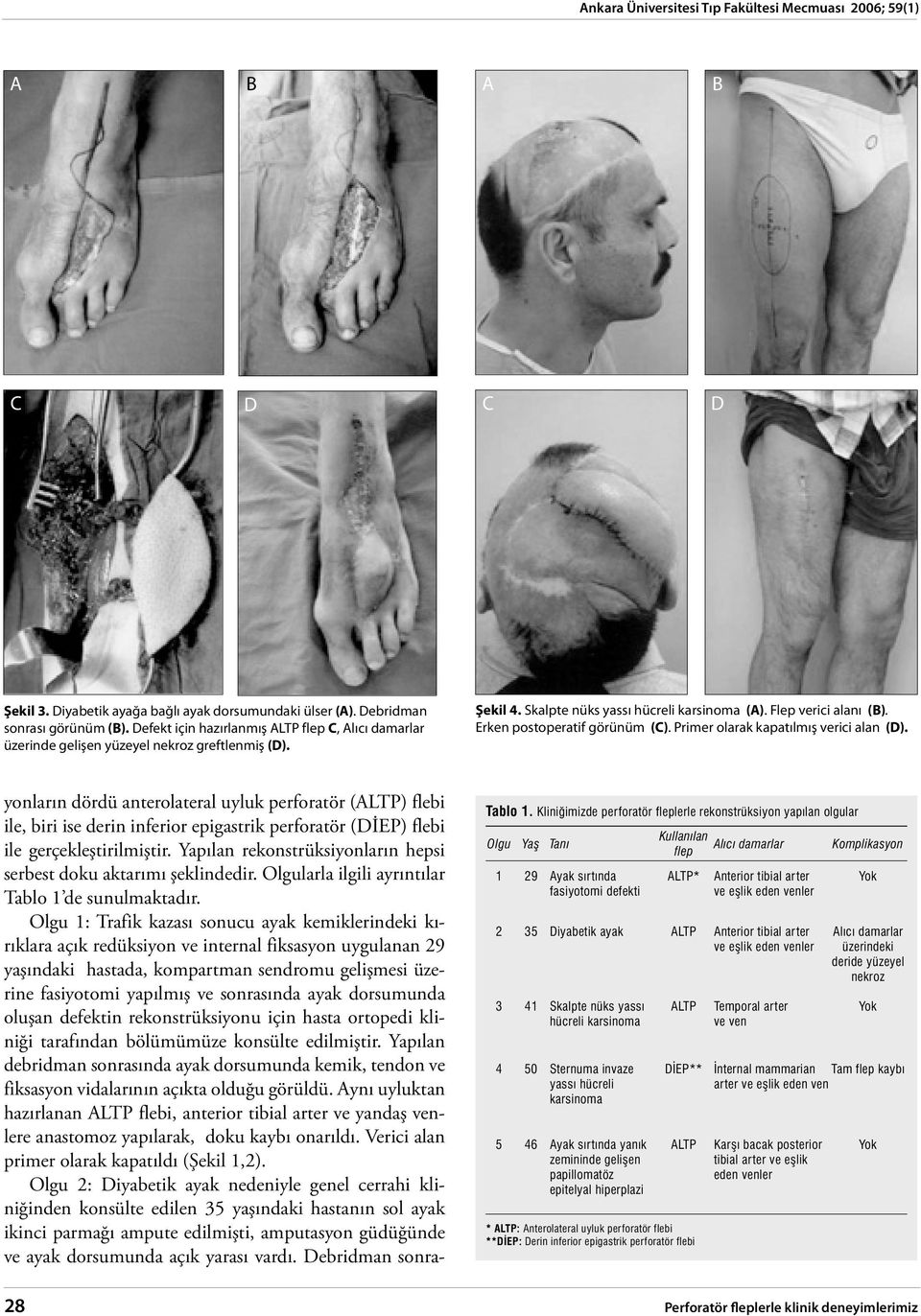 Primer olarak kapatılmış verici alan (). yonların dördü anterolateral uyluk perforatör (LTP) flebi ile, biri ise derin inferior epigastrik perforatör (İEP) flebi ile gerçekleştirilmiştir.