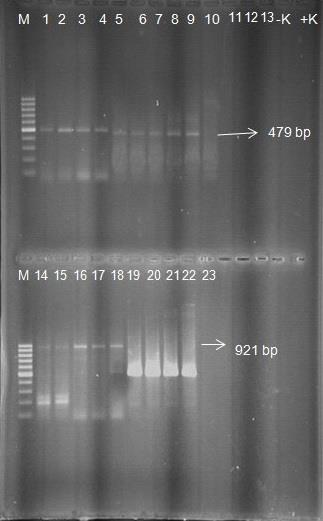 RT-PCR Çalışmaları ile İlgili Bulgular RT-PCR çalışmalarında 7081fw/7560rev primer çifti ile çoğaltılan tüm örneklerde 479 bp lik bant oluşumu gözlemlenmiştir.