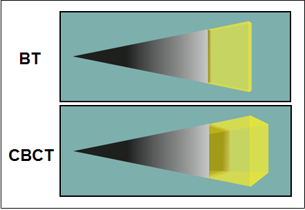 62 amorf silikon bir levha ya da solid bir sensör ile özel bir imaj intensifier tüpteki konik şekilli X ışını hüzmesini kullanır.