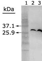 Şekil 3.10. Vt-GRA1 ve ko-gra1 protein ekspresyon seviyelerinin western blot ile karşılaştırılması.