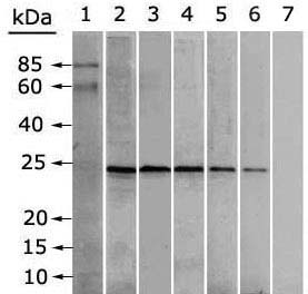 aşılanan ve sadece adjuvan verilen kontrol gruplarından alınan serum örnekleri, TAg de herhangi bir bağlanma göstermemişlerdir. Şekil 3.11. T. gondii eriyik antijenin aşılanmış farelere ait serum havuzları ile karşılaştırılması.