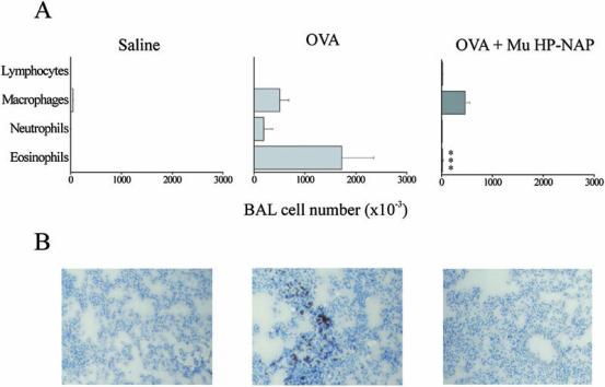 ġekil-2 HP-NAP ın sistemik uygulanıģı ovalbumin hayvan modelinde BAL örneklerinde IL-4, IL-5 ve GM CSF üretimini azaltmıģtır. 5-)Betts RJ & Kemeny DM (2009) CD8(1) T cells in asthma: friend or foe?