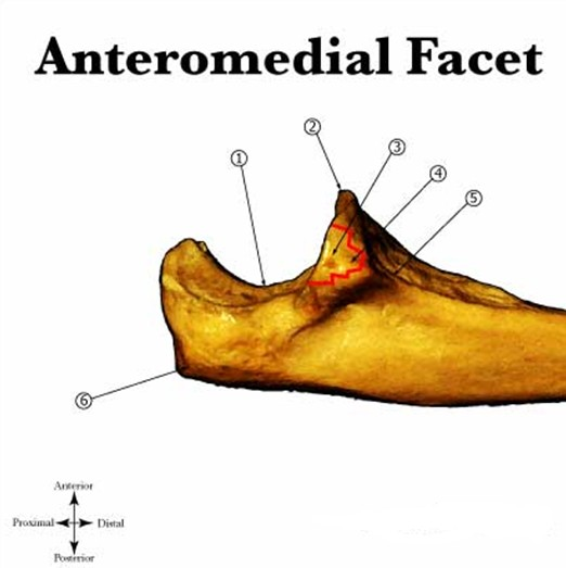 Coronoid