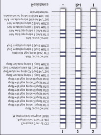 Antitüberküloz İlaç Direnci Laboratuvar Sürveyansı, 2012 Genetik direnç (n=2981) Rifampisin; Duyarlı 2746 7 (%0,3) si fenotipik R Dirençli 235 7