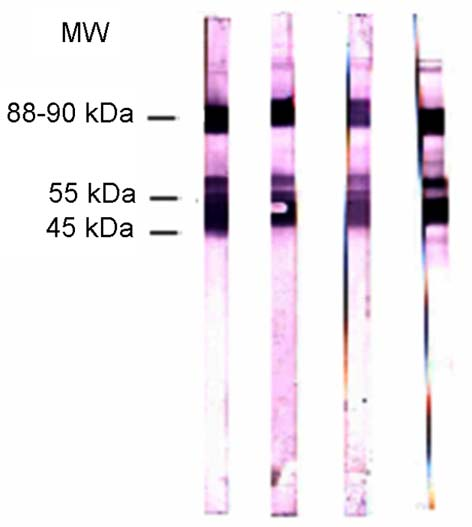 Trichinellosisde Western blot kda ve 64 kda bantlarını %100 sensitif olarak bulmalarının yanısıra, %98,8 ile en spesifik bantlar (sadece bir kontrolde, anisakiasis) olarak değerlendirilmiştir (18).