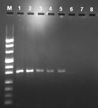 4.4 Moleküler Yöntem Sonuçları 4.4.1 PCR İncelemesi Leishmaniasisin tanısında moleküler yöntemlerden PCR kullanılmasına rağmen; bu yöntemin bazı dezavantajları vardır.