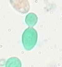 AMİTOZ BÖLÜNME Hücre bölünmesinin bir boğum sonucu ikiye ayrılmasıyla olur Önce nükleolus (çekirdekçik), sonra nükleus ve daha sonra sitoplazma uzayıp ortadan boğularak ikiye ayrılır Ayrılan