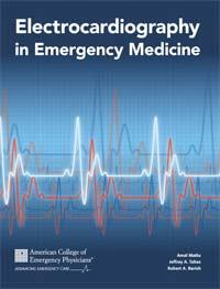 Akut koroner sendromunu taklit eden PE EKG: anterior-inferior iskemi Taburcu Bir sonraki gün kardiyak arrest Otopsi sonucu: büyük saddle embolus, 2 PE daha koroner arter hastalığı bulguları