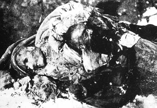 Erzincan õn işgalinde Odabaşõ Mahallesinde Ermeniler tarafõndan gözleri oyularak vahşice öldürülen Türkler. I.