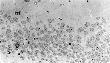 14 Epilepsi Cilt 7, Say 1-2, 2001 sonucu CA3 piramidal tabakas nda ve hilar bölgede hücre kayb oldu unu göstermifllerdir. Nadler ve ark.