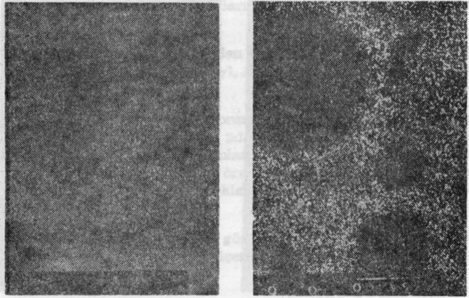 Resim 2a. Dispersalloy'un 2:1 Resim 2b. Dispersalloy'un 2:1 oranında kompozisyon görüntüsü. oranındaki Sn X-ray görüntüsü.
