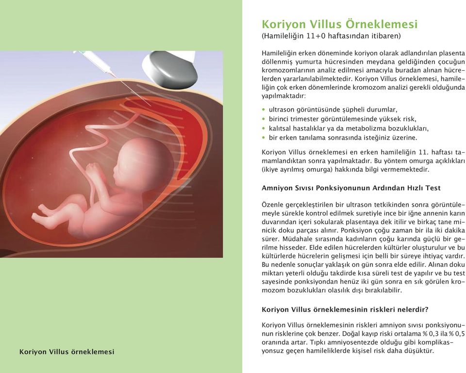Koriyon Villus örneklemesi, hamileliğin çok erken dönemlerinde kromozom analizi gerekli olduğunda yapılmaktadır: ultrason görüntüsünde şüpheli durumlar, birinci trimester görüntülemesinde yüksek