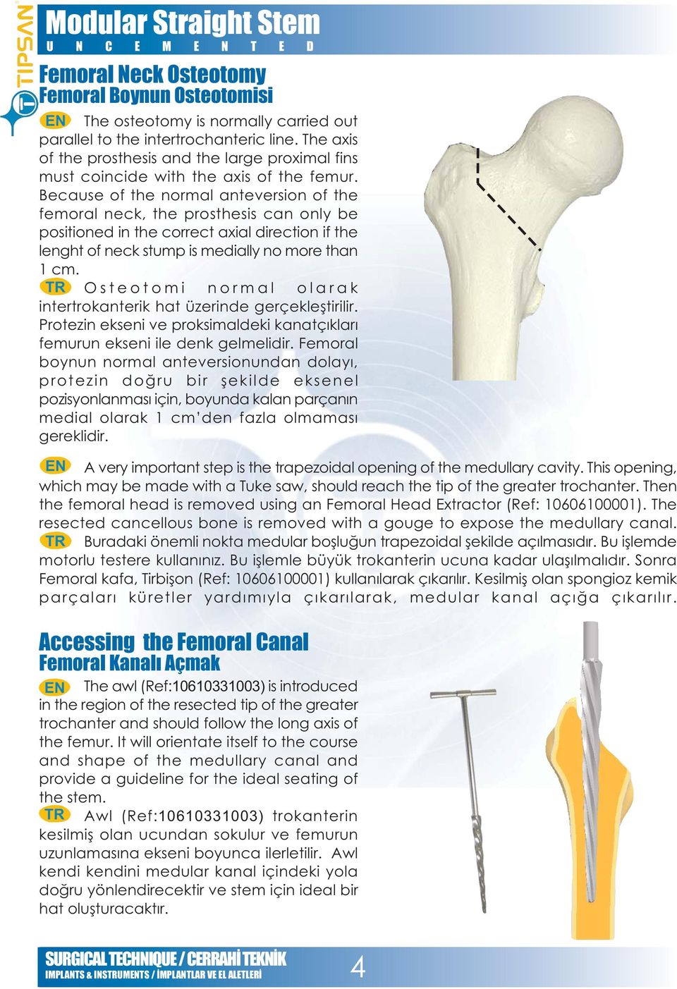 Because of the normal anteversion of the femoral neck, the prosthesis can only be positioned in the correct axial direction if the lenght of neck stump is medially no more than 1 cm.