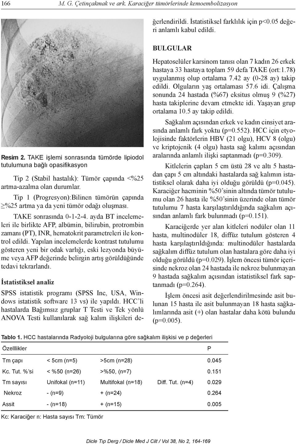 BULGULAR Resim 2. TAKE işlemi sonrasında tümörde lipiodol tutulumuna bağlı opasifikasyon Tip 2 (Stabil hastalık): Tümör çapında <%25 artma-azalma olan durumlar.