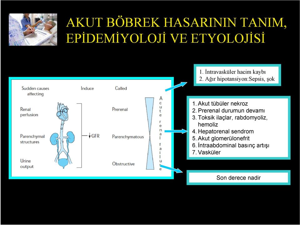 Akut tübüler nekroz 2. Prerenal durumun devamı 3.