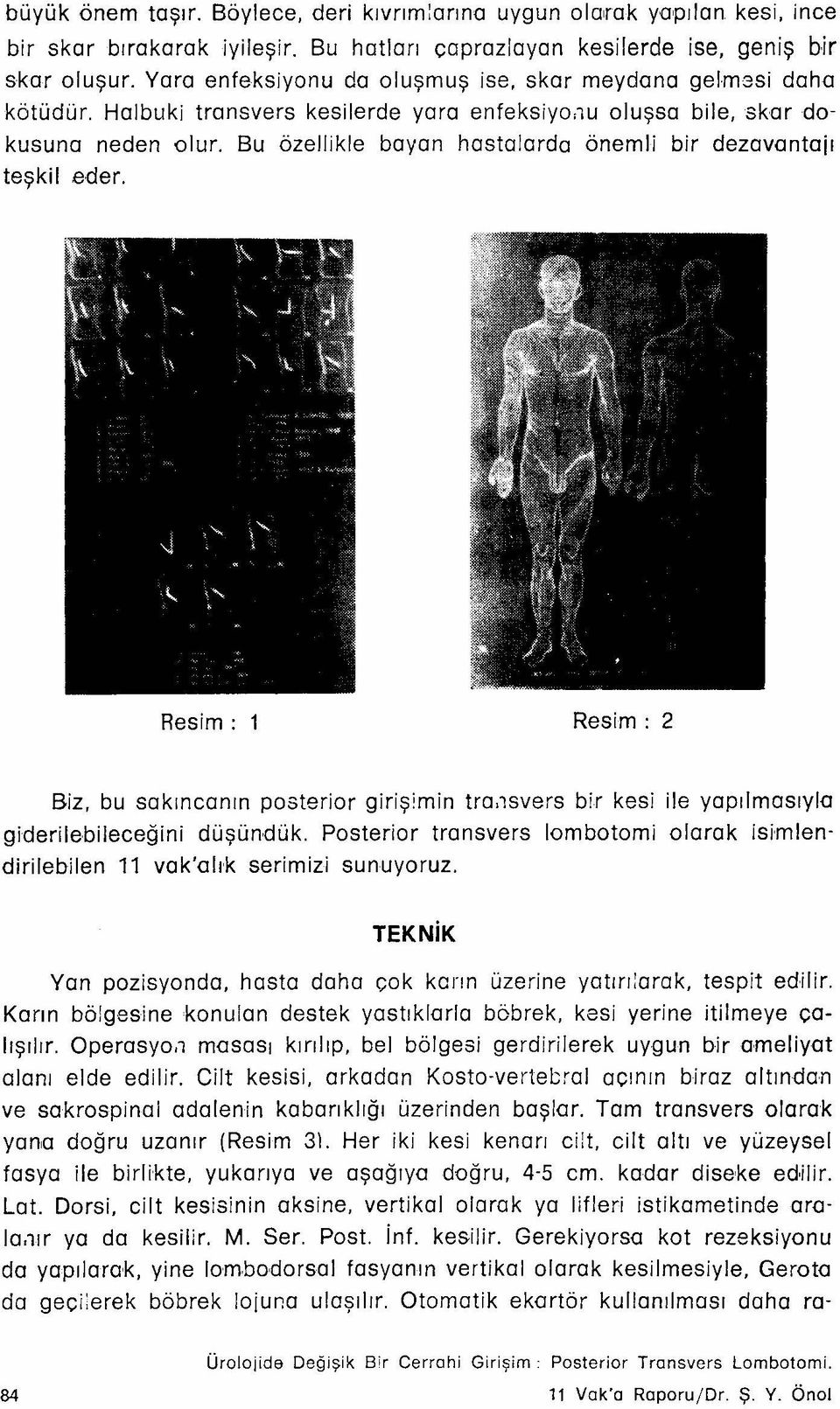 Bu özellikle bayan hastalarda önemli bir dezavantajı teşkil eder. Resim: 1 Resim: 2 Biz, bu sakıncanın posterler girişimin tro.ısvers bir kes i ile yapılmasıyla giderilebileceğini düşündük.