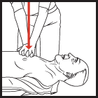 Kardiyak bası Yüksek kaliteli CPR Bası güçlü (>5cm) ve hızlı (>100/dk) Göğüsün genişlemesine izin vermeli Basıya ara minimal olmalı Aşırı ventilasyondan