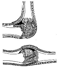 Articulationes Metacarpophalangeae (MCP II-MCP V) Kondiler tip eklemlerdendir. Eklem yüzeyleri metakarpal tarafta konveks, falangeal tarafta konkavdır.